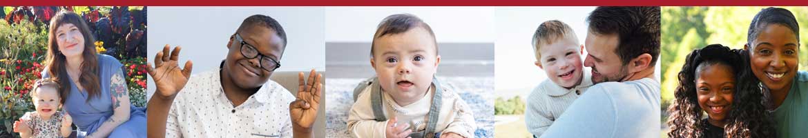 series of 5 kids with Down Syndrome